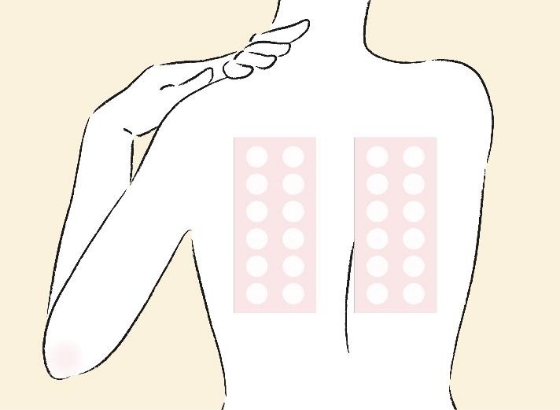 パッチテスト (24時間連続貼付)