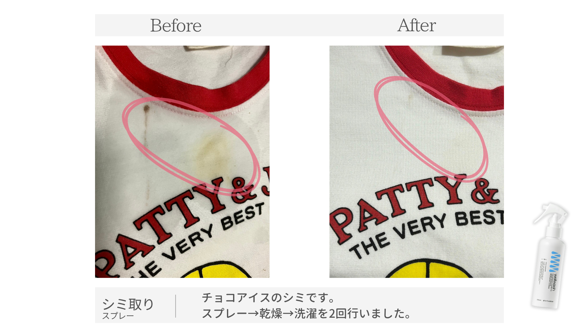 シミ取りスプレー ビフォーアフター